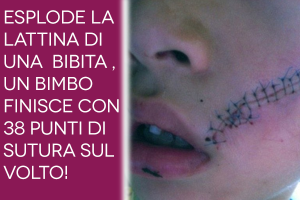 bimbo-sfigurato lattina esplosiva
