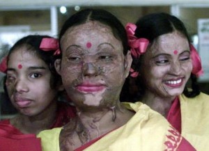 acidvictims