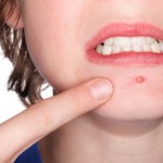 10 Trucchi Semplicissimi Per Sconfiggere Brufoli E Pelle Grassa