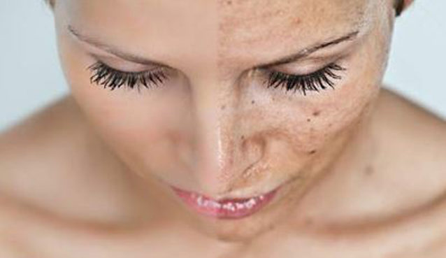 eliminare macchie scure viso