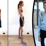 Incubo Anoressia: 10 Scioccanti Fotografie