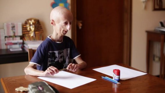 Sammy Basso, Una Nuova Avventura Per Vivere Nonostante la Progeria Sammy Basso, Una Nuova Avventura Per Vivere Nonostante la Progeria