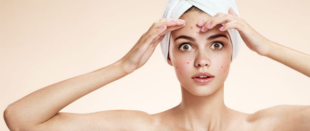 9 Cose che Ti Fanno Venire l'Acne Senza che Tu lo Sappia 9 Cose che Ti Fanno Venire l'Acne Senza che Tu lo Sappia