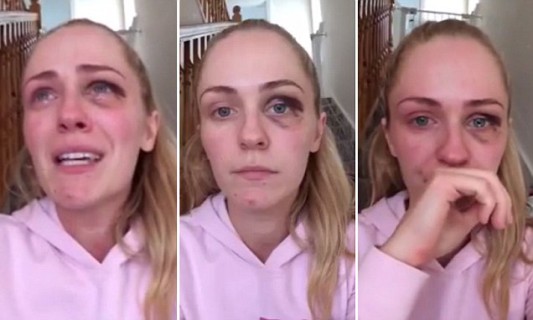 "Era l'Amore della mia Vita": il Video Shock di Emma per dire No alla Violenza Domestica "Era l'Amore della mia Vita": il Video Shock di Emma per dire No alla Violenza Domestica
