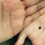 Un Puntino nero sulla Mano per Denunciare in Silenzio le Violenze Domestiche