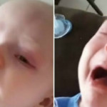 "Vaccinate i Vostri Figli": Mamma Pubblica Video del suo Bimbo con la Pertosse