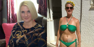 suzanne dore colostomia fashion blog