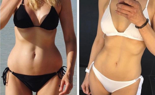 Estetista Cinica VS Bufale fitness: "I risultati miracolosi di Kayla Itsines? Merito di Photoshop" Estetista Cinica VS Bufale fitness: "I risultati miracolosi di Kayla Itsines? Merito di Photoshop"