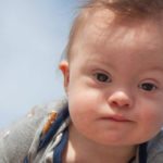 Il paese in cui stanno scomparendo i bambini affetti da sindrome di Down