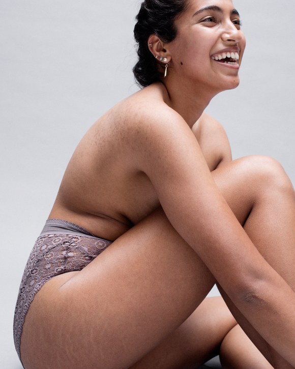 LoveYourLines: 6 donne mostrano e raccontano le loro smagliature
