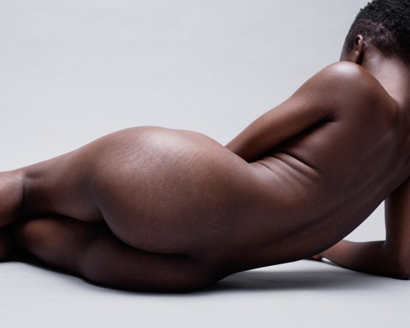 LoveYourLines: 6 donne mostrano e raccontano le loro smagliature