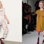 La lezione di vita di Daisy-May Demetre, modella amputata di 8 anni