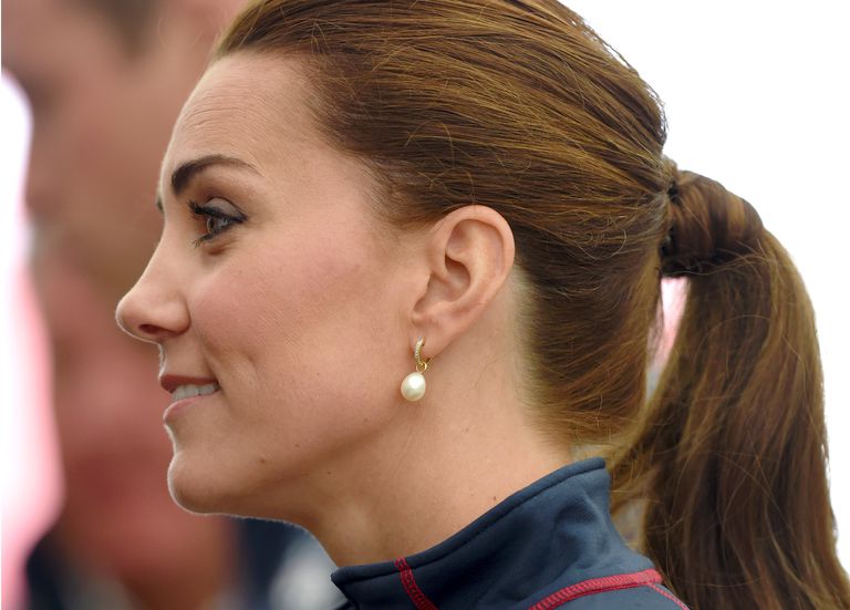 La storia segreta dietro la grande cicatrice di Kate Middleton