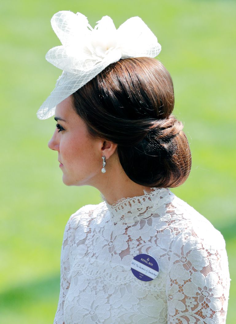 La storia segreta dietro la grande cicatrice di Kate Middleton