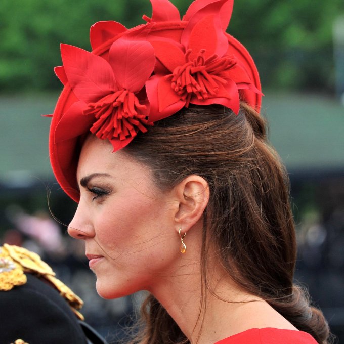 La storia segreta dietro la grande cicatrice di Kate Middleton
