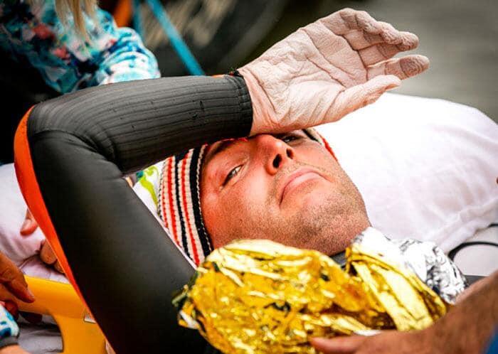 Come diventa le pelle dopo 55 ore in acqua: la storia del nuotatore Maarten