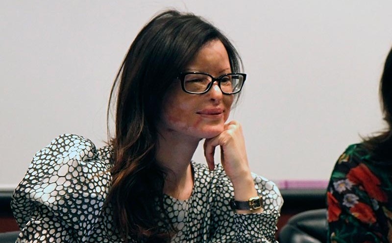 Lucia Annibali, la donna cui hanno rubato il volto non l'anima