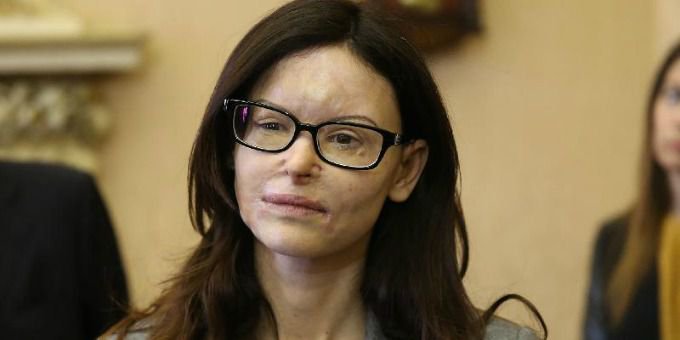 Lucia Annibali, la donna cui hanno rubato il volto non l'anima