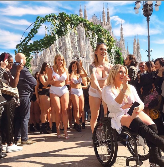Benedetta De Luca: "Non ho sofferto per nulla: voglio mostrare le cicatrici sulle gambe"