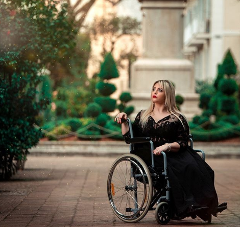 Benedetta De Luca: "Non ho sofferto per nulla: voglio mostrare le cicatrici sulle gambe"