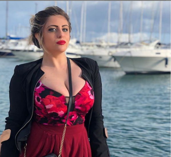 Benedetta De Luca: "Non ho sofferto per nulla: voglio mostrare le cicatrici sulle gambe"