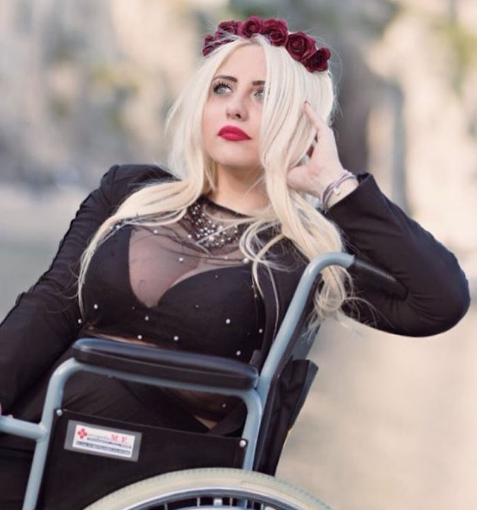 Benedetta De Luca: "Non ho sofferto per nulla: voglio mostrare le cicatrici sulle gambe"