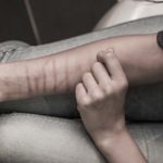 "Mi sono autolesionata tutto il corpo ma i vostri sguardi fanno ancora più male"