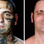 "Come e perché ho rimosso i tatuaggi razzisti dal mio volto"