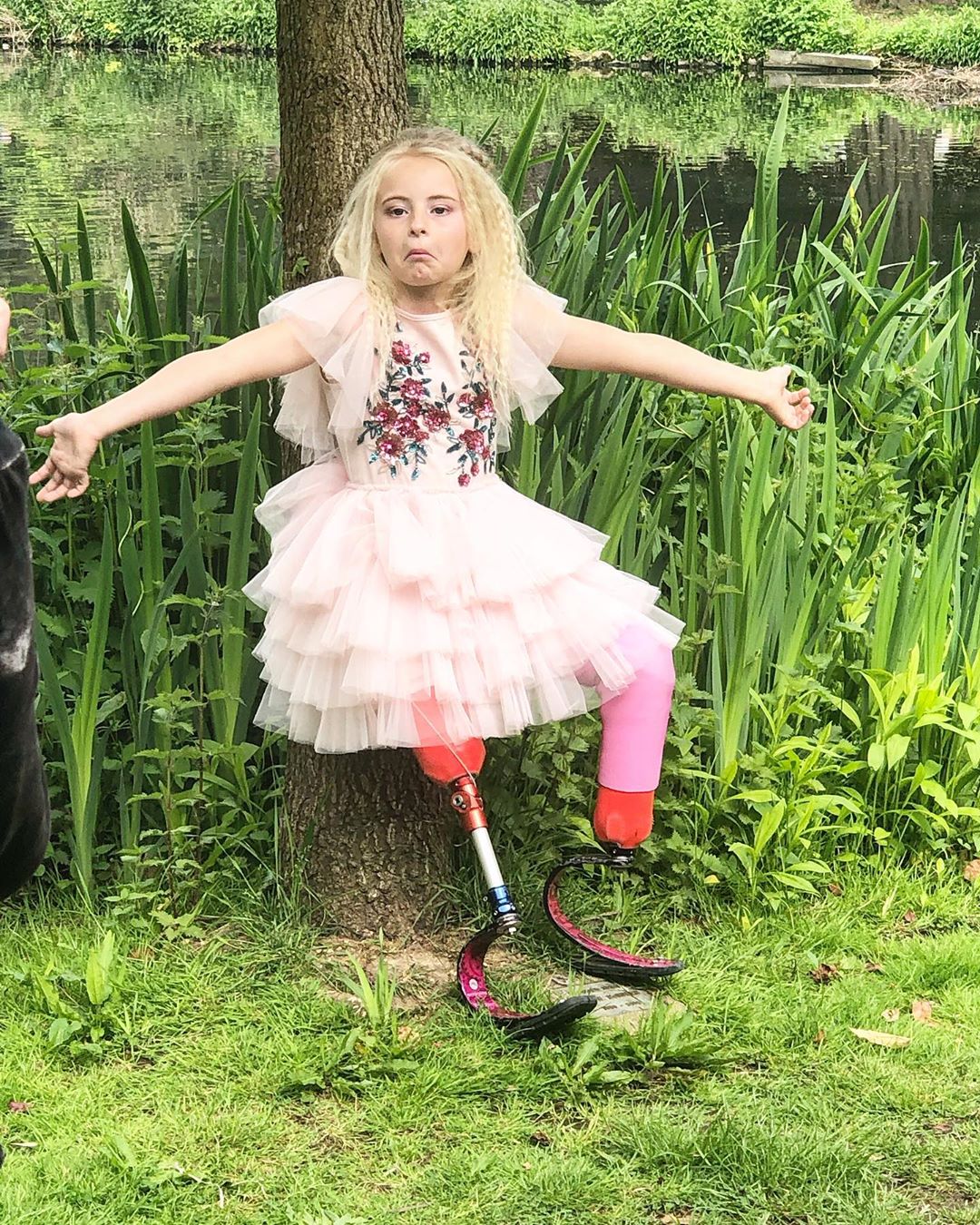 La lezione di vita di DaisyMay Demetre, modella amputata di 9 anni