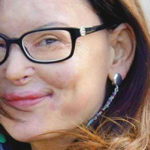 Lucia Annibali, la donna cui hanno rubato il volto non l'anima