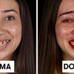 14 prima e dopo dei pazienti poveri del dentista che regala loro un sorriso nuovo