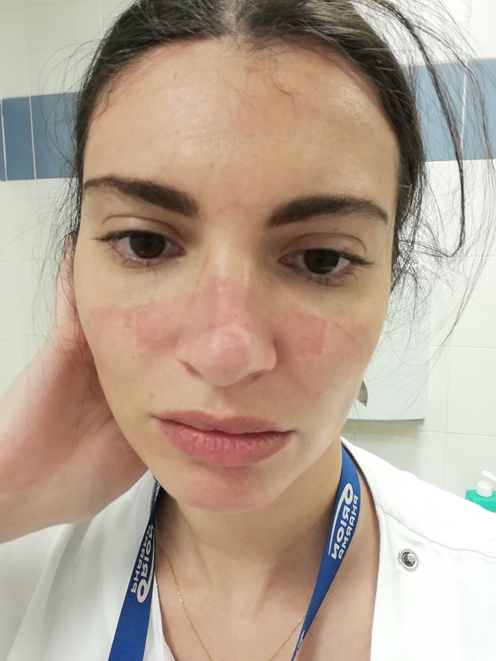 I segni sul volto delle donne che stanno combattendo il Coronavirus in prima linea