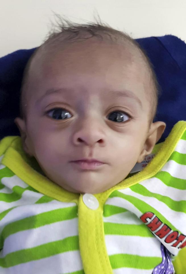 Manushi, la bambina prematura più piccola del mondo torna a casa