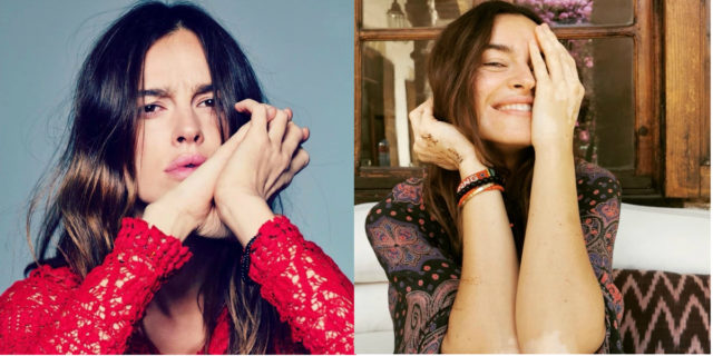 Kasia Smutniak: "Non toccate le mie rughe e la mia vitiligine"