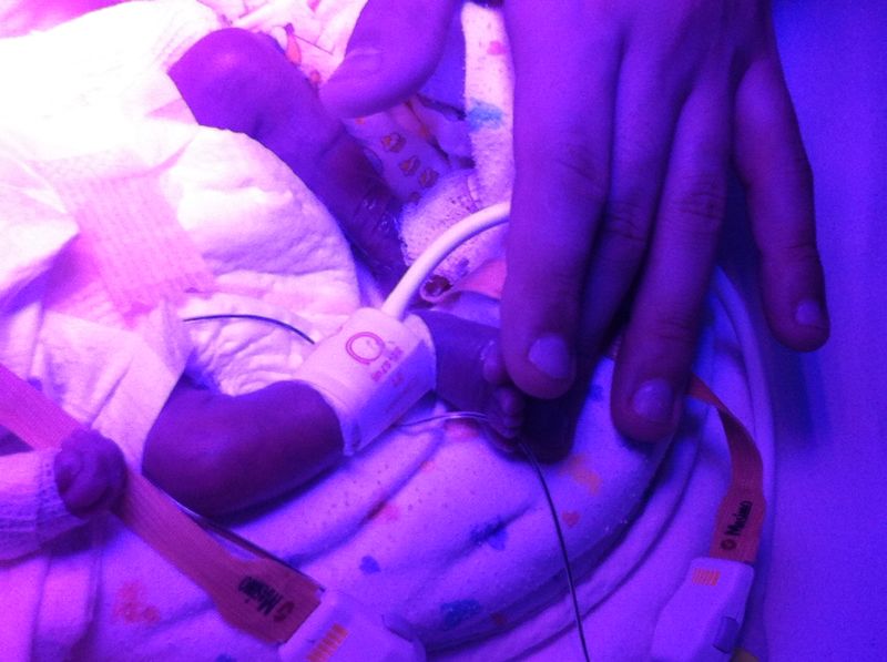"Isaac ha 3 anni, aiutatelo a non restare tracheotomizzato a vita"