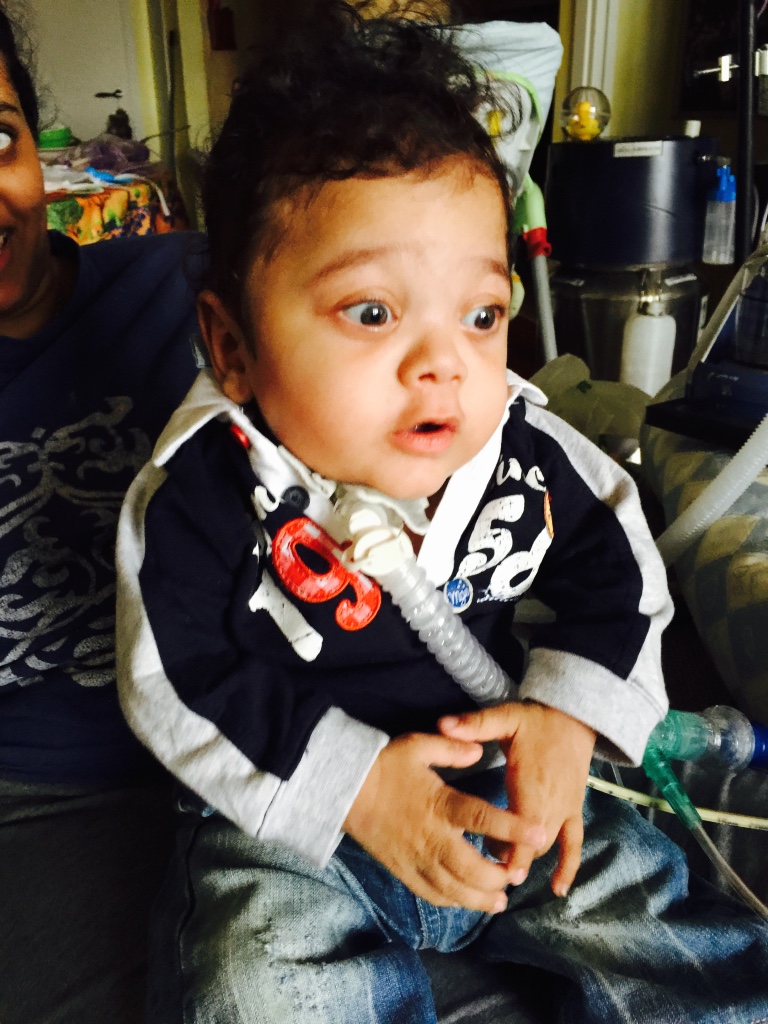 "Isaac ha 3 anni, aiutatelo a non restare tracheotomizzato a vita"