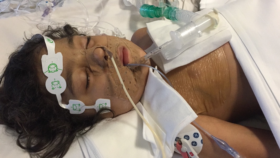 "Isaac ha 3 anni, aiutatelo a non restare tracheotomizzato a vita"