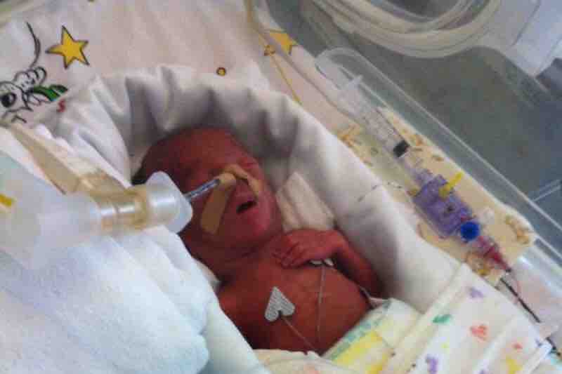 "Isaac ha 3 anni, aiutatelo a non restare tracheotomizzato a vita"