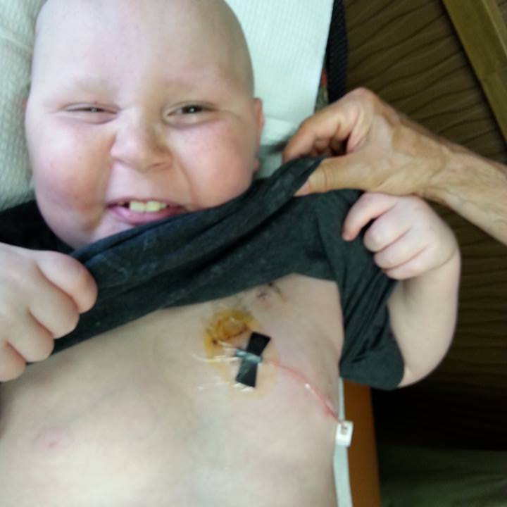Il papà si era tatuato la stessa cicatrice del figlio, ma Gabe non ce l'ha fatta
