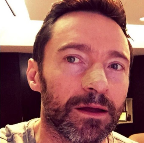 Hugh Jackman, al mare totalmente coperto per sensibilizzare all’uso delle protezioni solari
