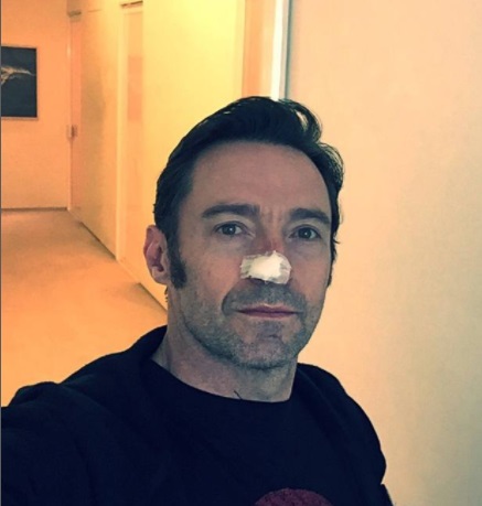 Hugh Jackman, al mare totalmente coperto per sensibilizzare all’uso delle protezioni solari