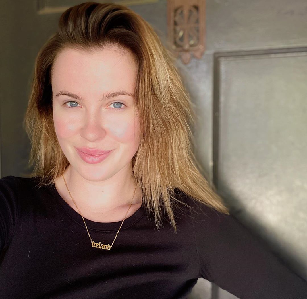 Chi è Ireland Baldwin, la figlia di Kim Basinger e Alec Baldwin