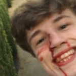 Pestato a sangue perché gay, risponde con un sorriso e queste parole