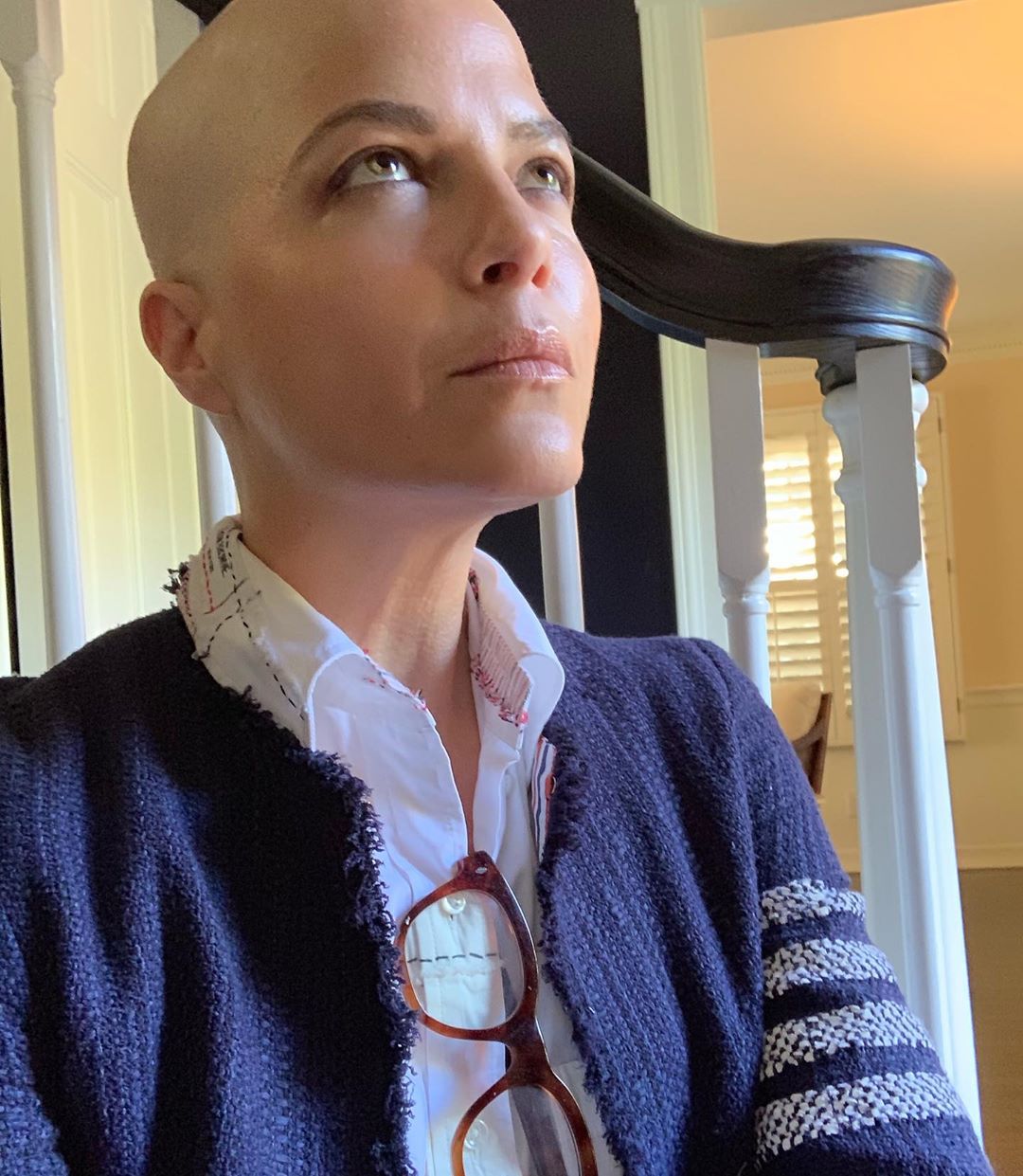 Selma Blair e la forza di mostrare, senza capelli, la sclerosi multipla