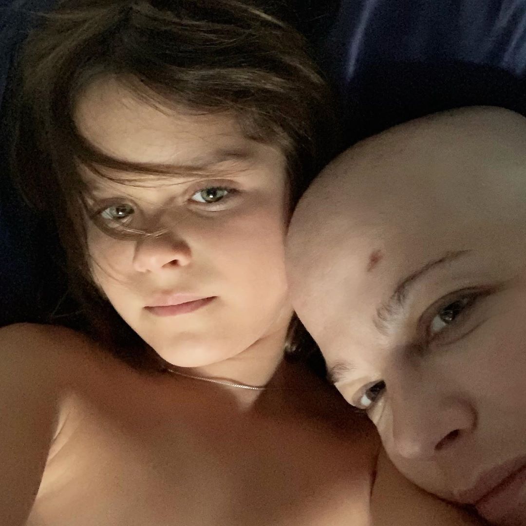 Selma Blair e la forza di mostrare, senza capelli, la sclerosi multipla