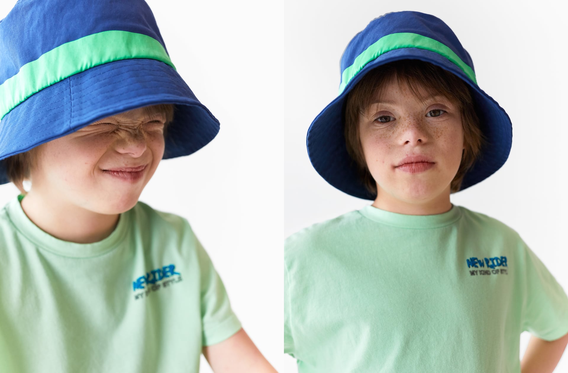 Chi è Patrick, il bimbo affetto da sindrome di Down che posa per Zara