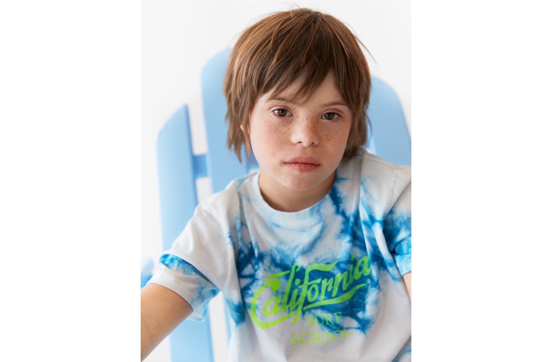 Chi è Patrick, il bimbo affetto da sindrome di Down che posa per Zara