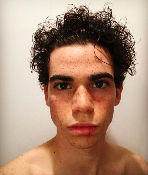 Si può morire nel sonno per crisi epilettica? L’esperto sul caso Cameron Boyce