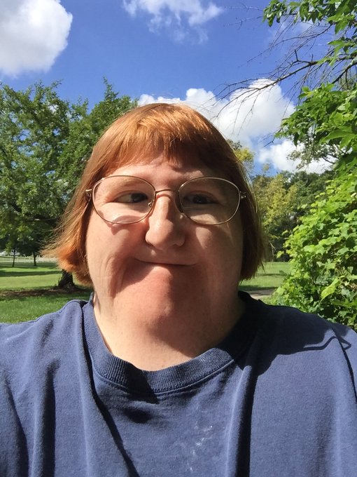 “Sei troppo brutta per i selfie”: la risposta della blogger disabile Melissa Blake