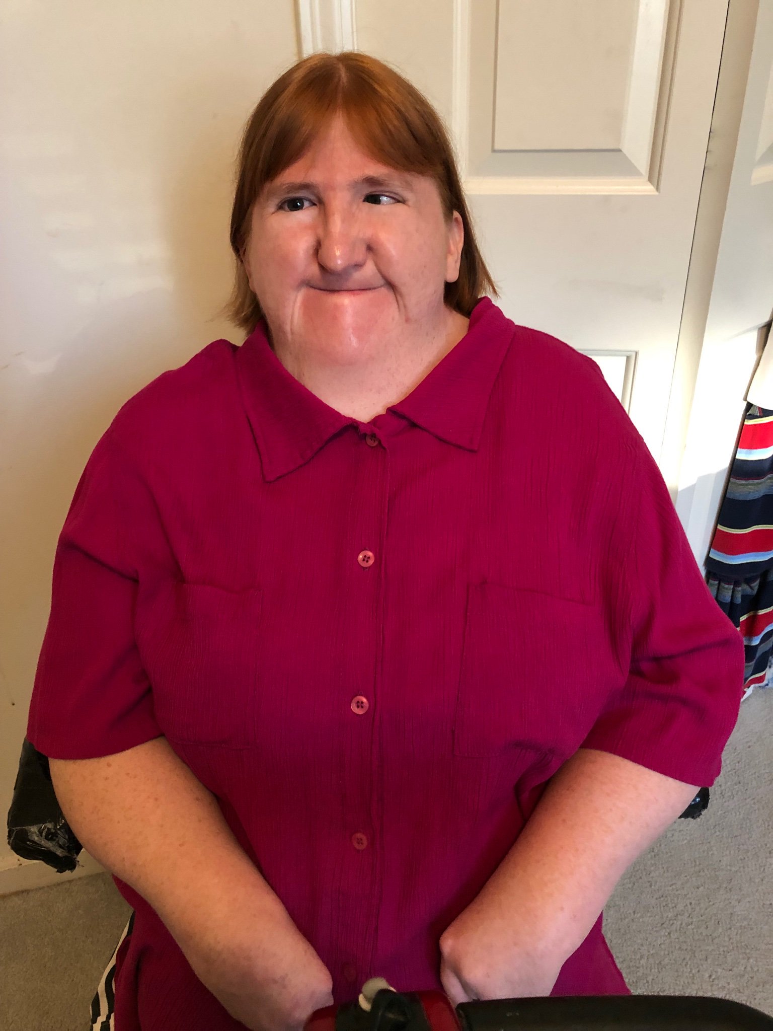 “Sei troppo brutta per i selfie”: la risposta della blogger disabile Melissa Blake